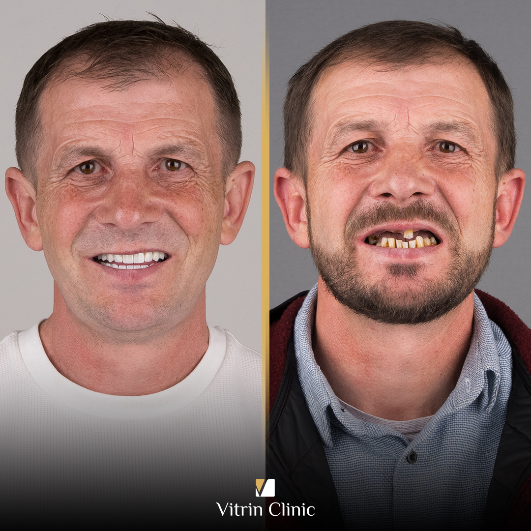 Vitalii b&a